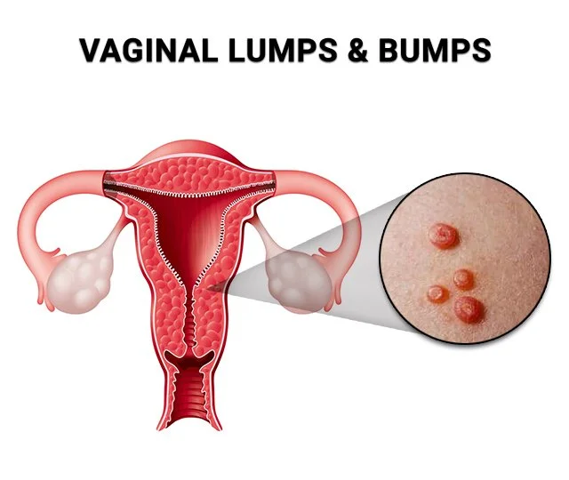 devi purnamasari recommends what does a vaginal pump do pic