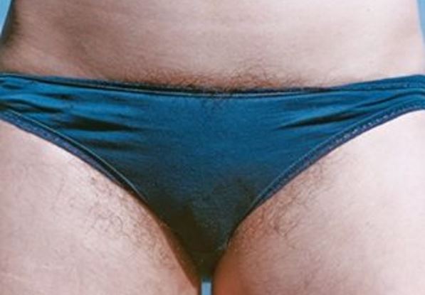 aaron dandrea recommends Hairy Teen Bikini