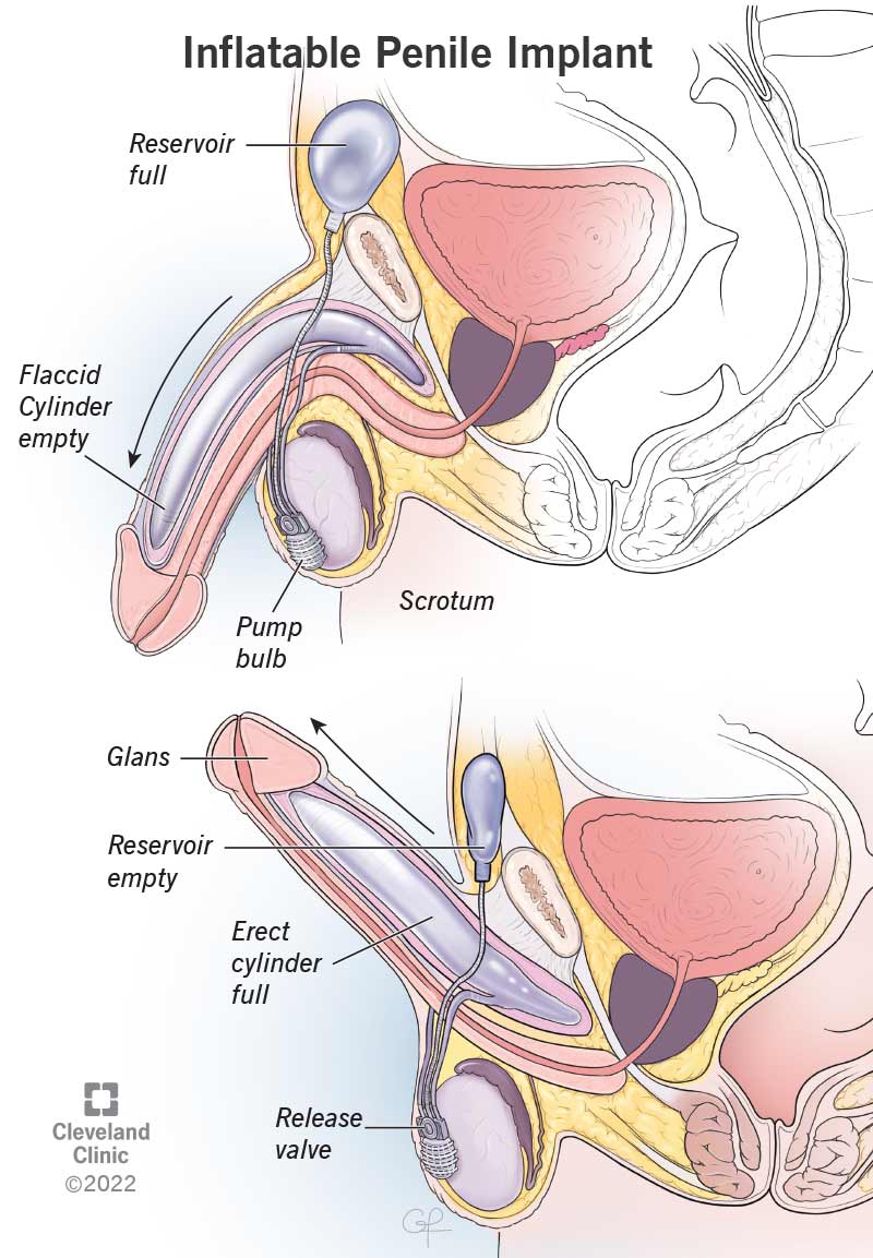 brittany yant recommends why does my penis pulsate pic