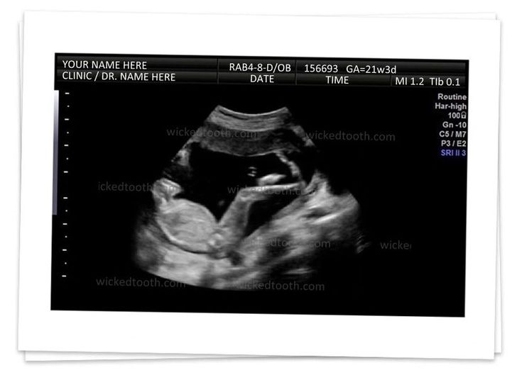 bill renner add fake ultrasound online free photo