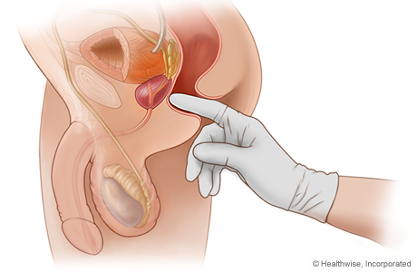 Female Rectal Exams Video and harleys