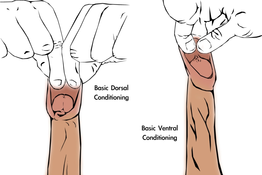 Foreskin Restoration Before And After oil sex