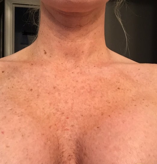 amanda galeczka recommends freckles on boobs pic