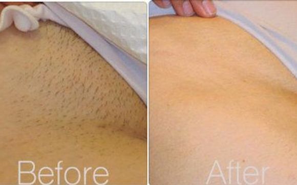 alvin c porter recommends full brazilian wax pictures pic