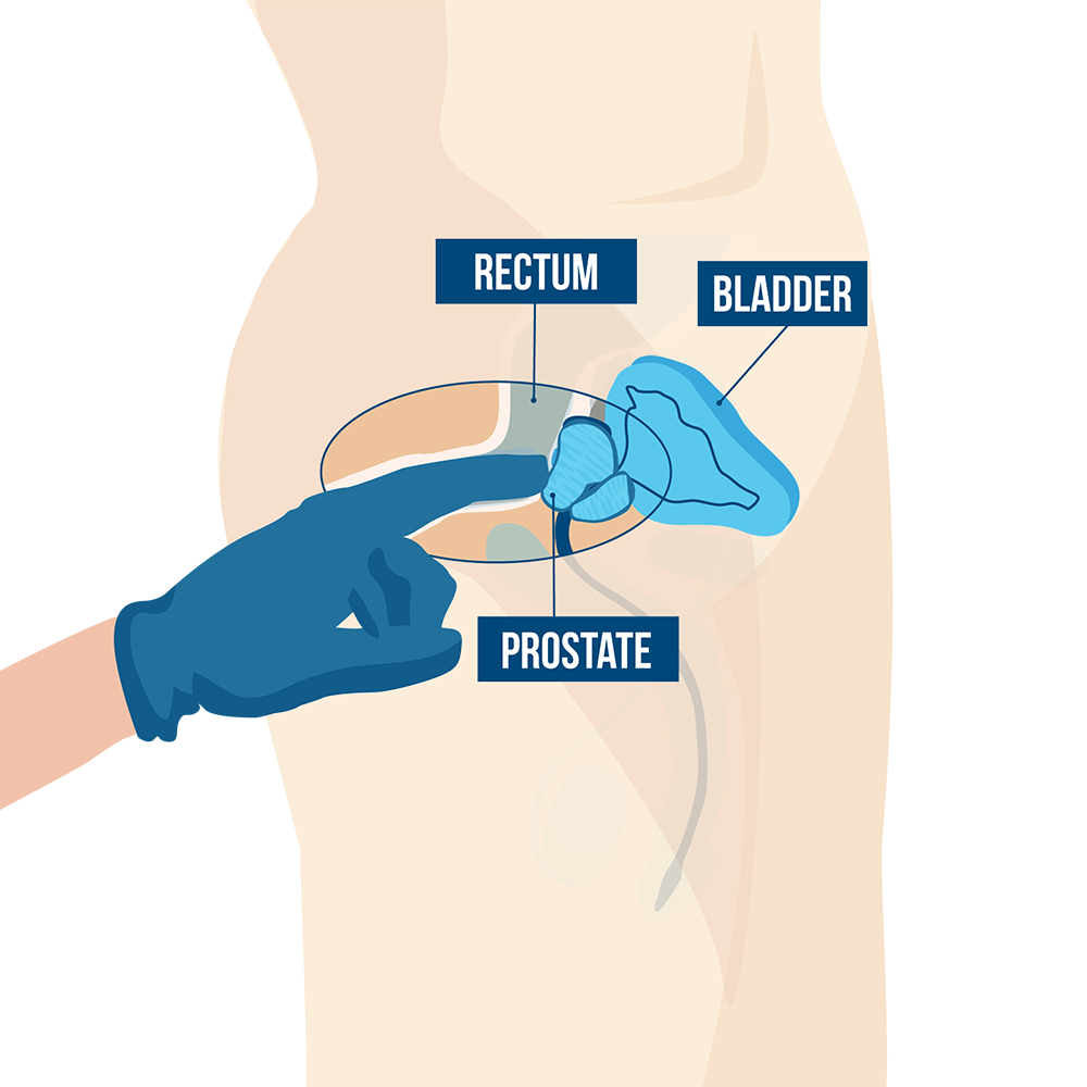 andrea gillette recommends Hands Free Prostate Ejaculation