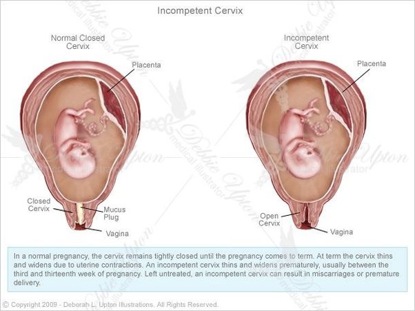 abby hein add photo hitting the cervix