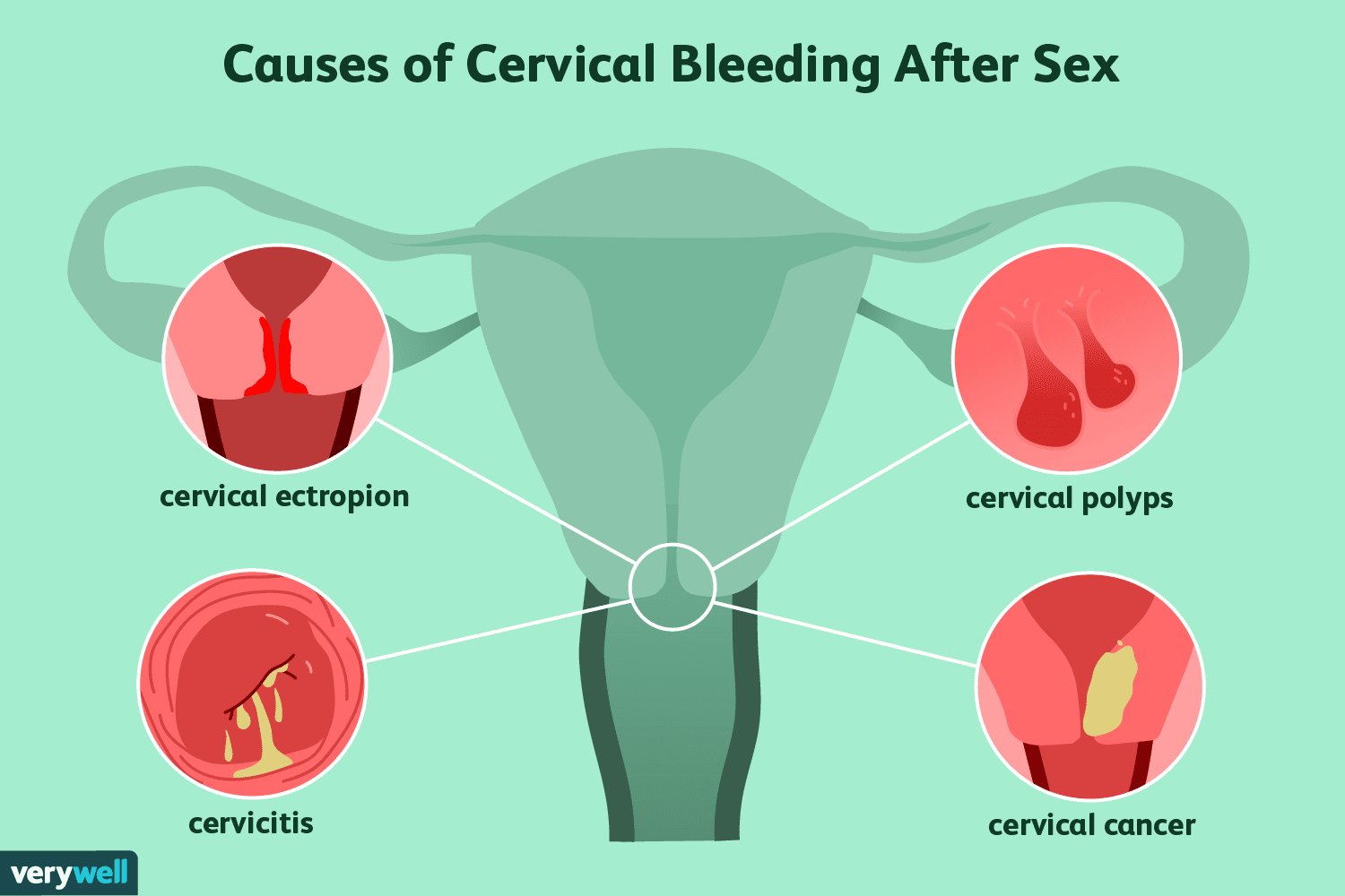 alex dejean recommends hitting the cervix pic