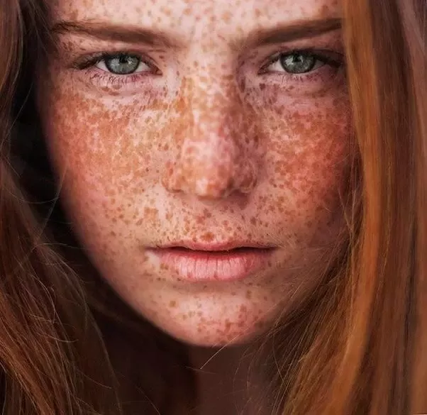 alan nadler share hot chicks with freckles photos