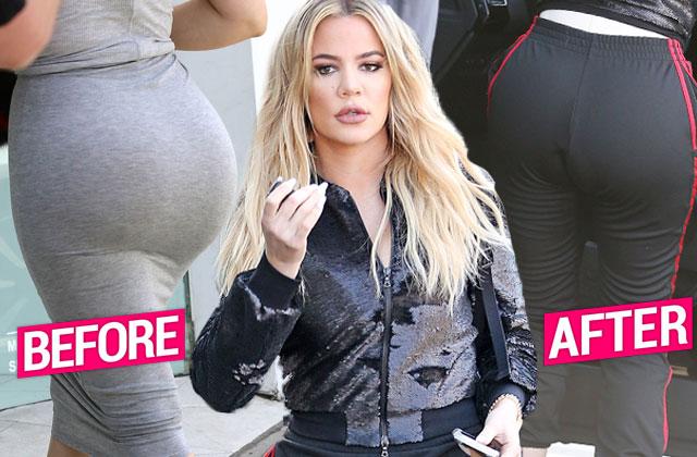 is khloe kardashians butt fake