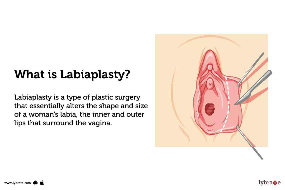 aniya williams recommends large labial folds pic