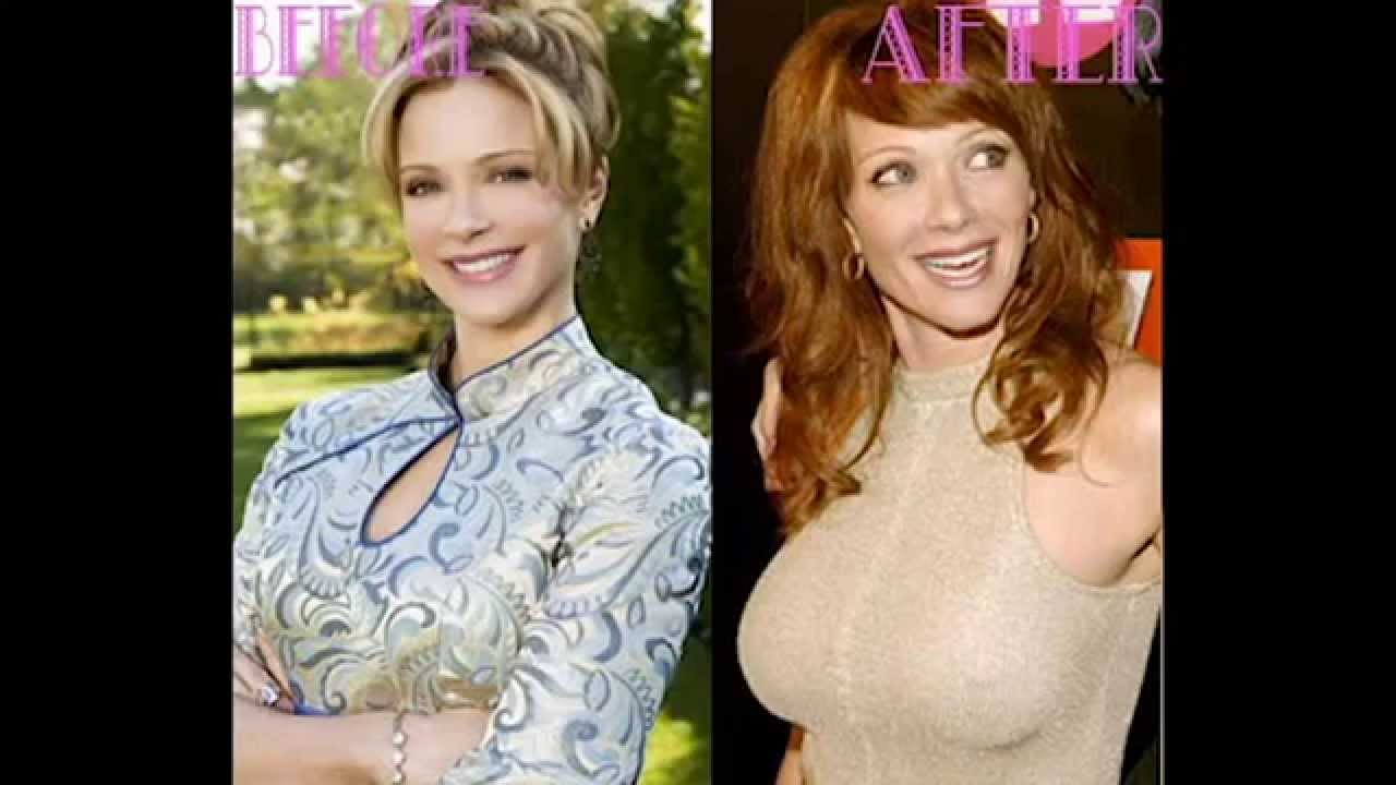 amer saadeh share lauren holly breast implants photos
