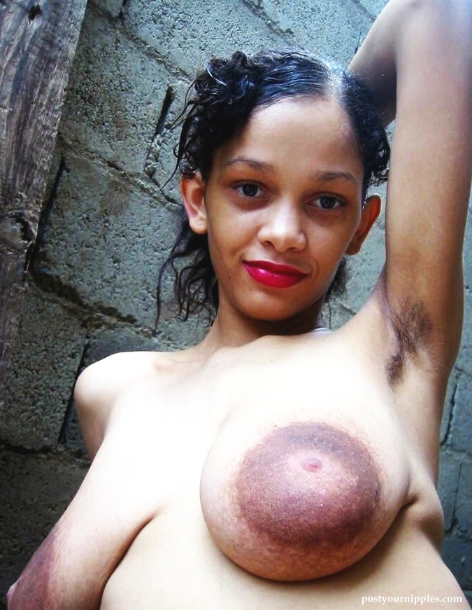 pictures of huge areolas