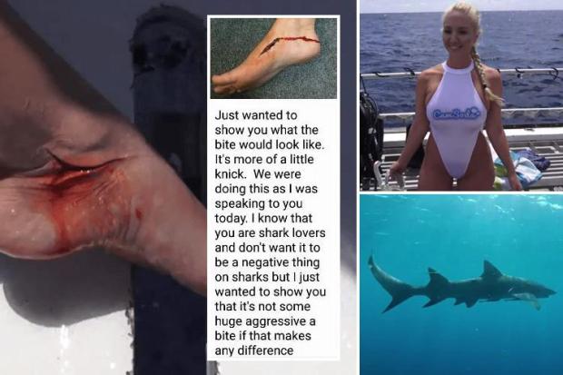 Best of Pornstar attacked by shark