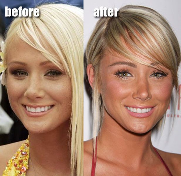 dorothy slone recommends Sara Jean Underwood Before And After