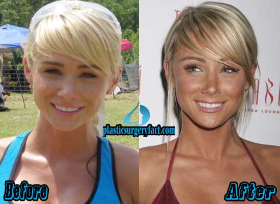 brian humphries add sara jean underwood before and after photo