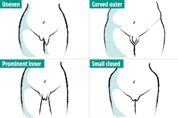 Best of Small vaginas pictures