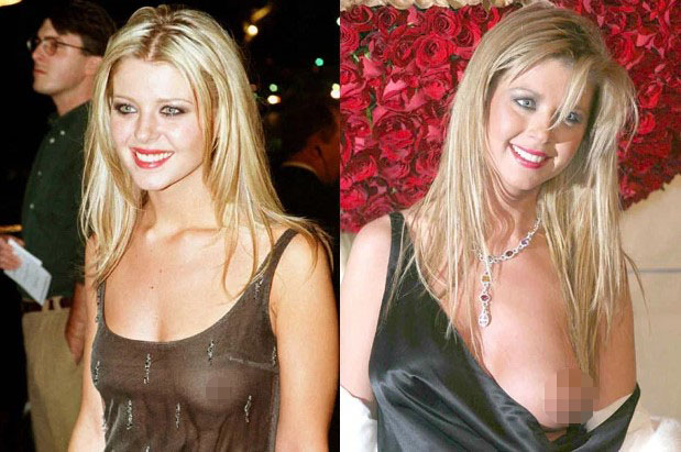 angelica colmenero add photo tara reid boob pic