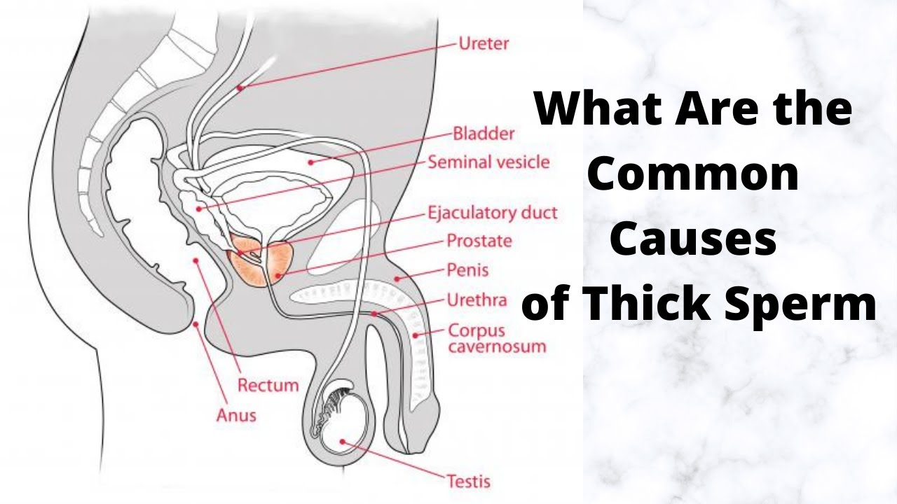 dale wempen recommends Why Is My Cum Chunky