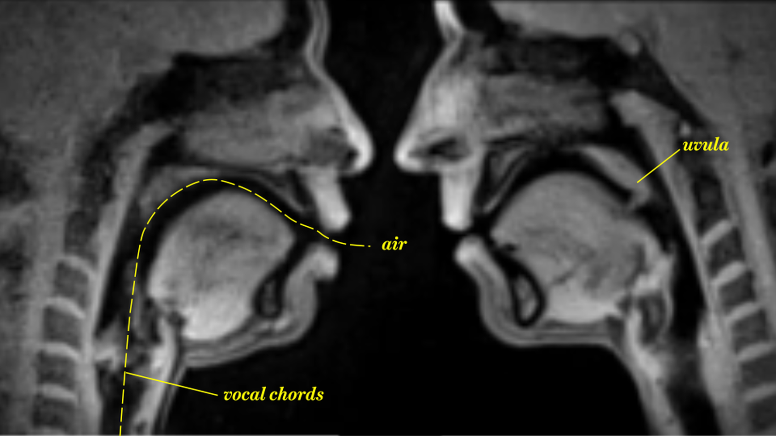 daniel asyraf recommends X Rays Of People Having Sex