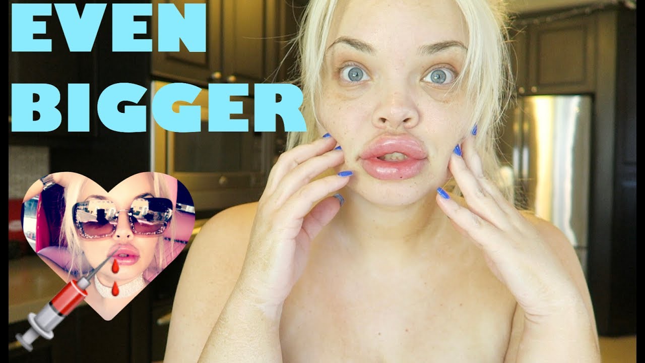 Best of Youtuber with big lips